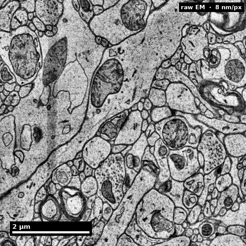 Raw H01 image at the same field and scale as the labeled view.